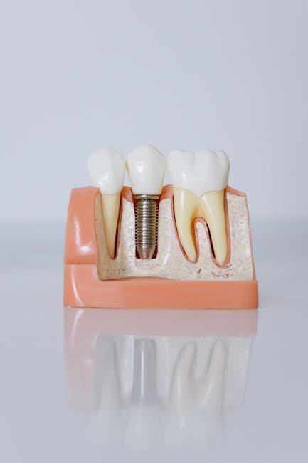 “Maximize Your Coverage: A Complete Guide to Incorporating Dental Implant Costs into Your Health Insurance Plan”